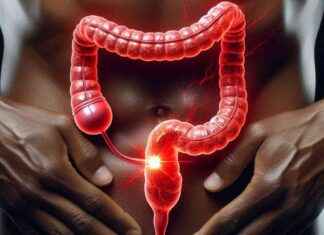 Campaña de prevención del cáncer de colon y recto alcanza nuevo récord campaa-de-prevencin-del-cncer-de-colon-y-recto-alcanza-nuevo-rcord