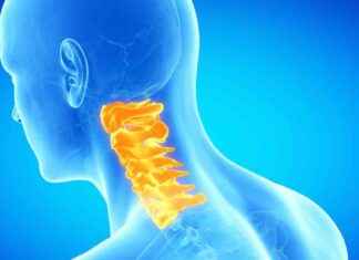 El principal dolor físico de los habitantes de Madrid el-principal-dolor-fsico-de-los-habitantes-de-madrid